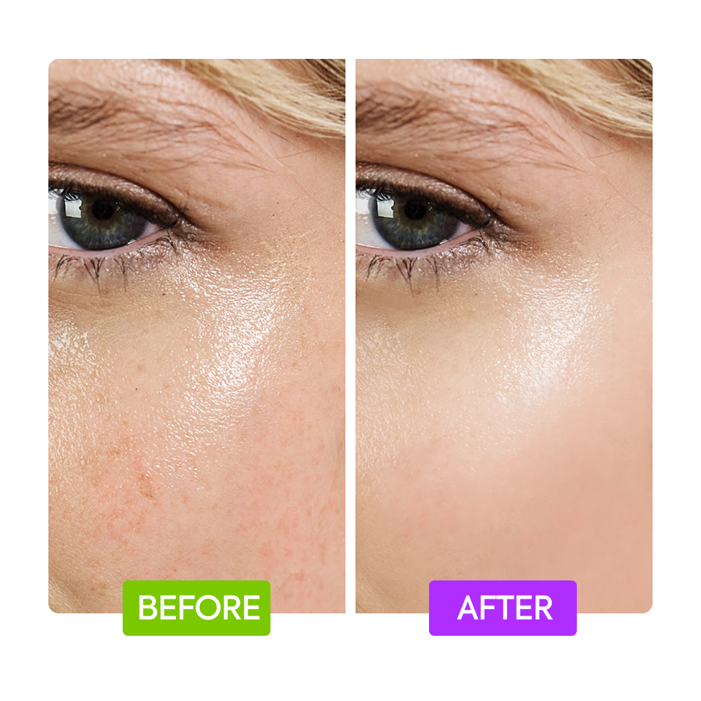 https://cdn.shopify.com/s/files/1/0724/5827/3064/files/Before-After-IYKYK-Booster-Purple-Green.png?v=1765403100
