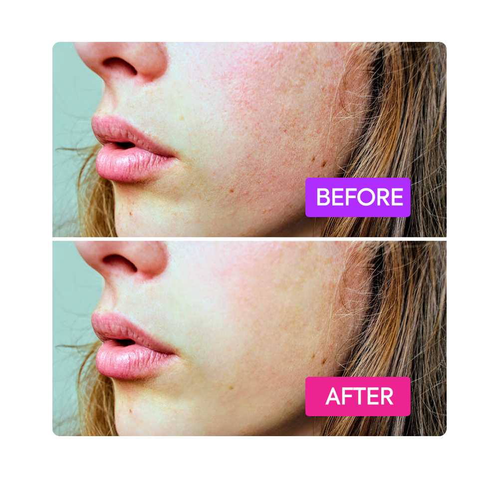 https://cdn.shopify.com/s/files/1/0724/5827/3064/files/Before-After-IYKYK-Booster-Purple-Magenta.png?v=1765404061