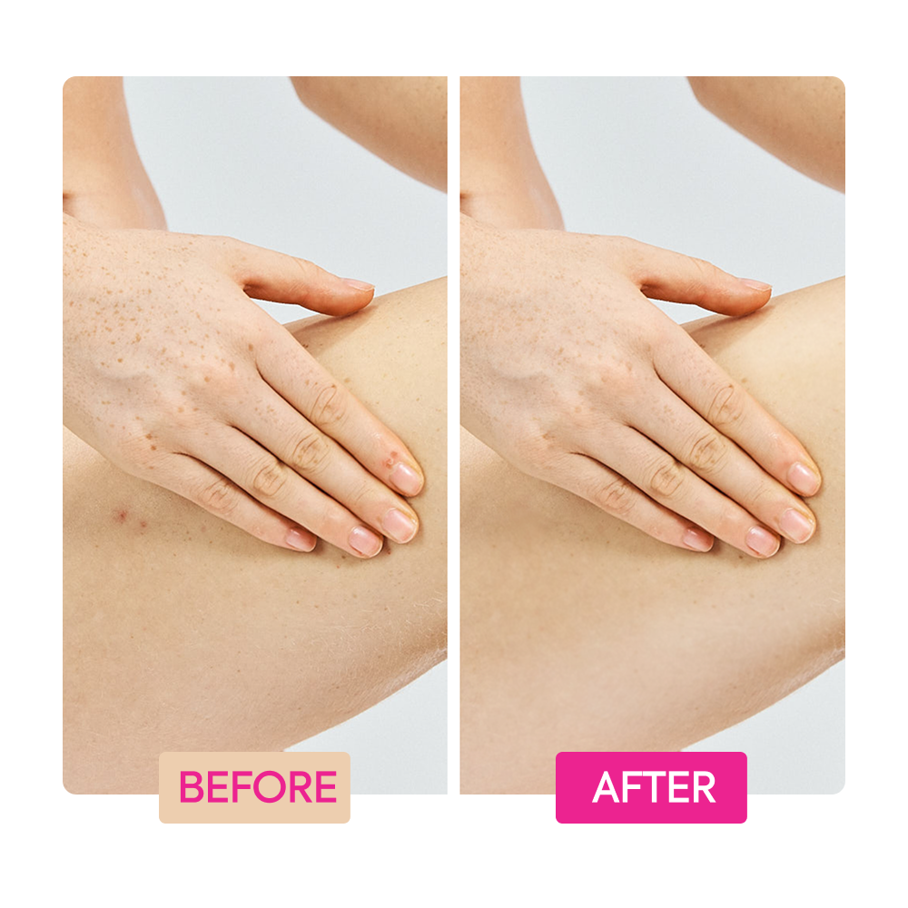 https://cdn.shopify.com/s/files/1/0724/5827/3064/files/Before-After-IYKYK-Lotion-Magenta.png?v=1764890316