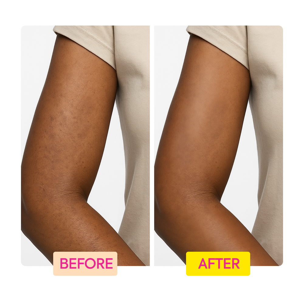 https://cdn.shopify.com/s/files/1/0724/5827/3064/files/Before-After-IYKYK-Lotion-Yellow.png?v=1764888723