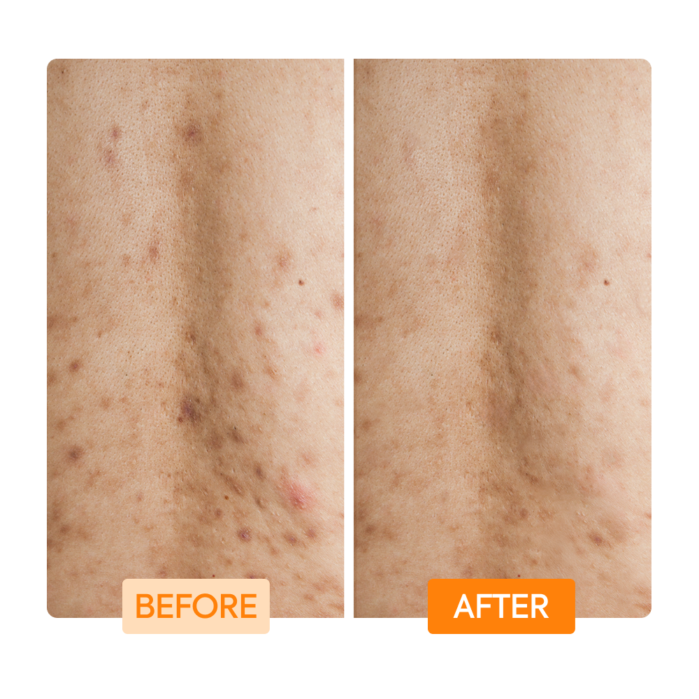 https://cdn.shopify.com/s/files/1/0724/5827/3064/files/Before-After-IYKYK_Body_Wash_Orange_880bd142-8852-4a61-b21a-35d7a727791e.png?v=1755554508