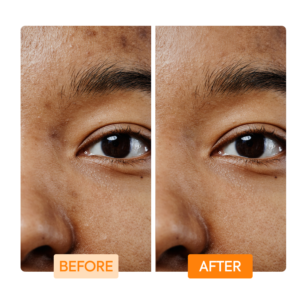 https://cdn.shopify.com/s/files/1/0724/5827/3064/files/Before-After-IYKYK_Soap_Facial_Orange.png?v=1765408561