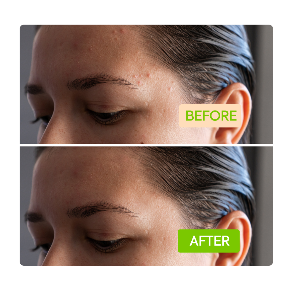 https://cdn.shopify.com/s/files/1/0724/5827/3064/files/Before-After-IYKYK_Soap_Green.png?v=1765404981