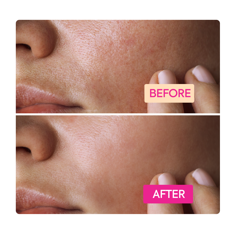 https://cdn.shopify.com/s/files/1/0724/5827/3064/files/Before-After-IYKYK_Soap_Pink_50d362fd-745b-48a9-a4a7-430dba3f5f20.png?v=1765406775